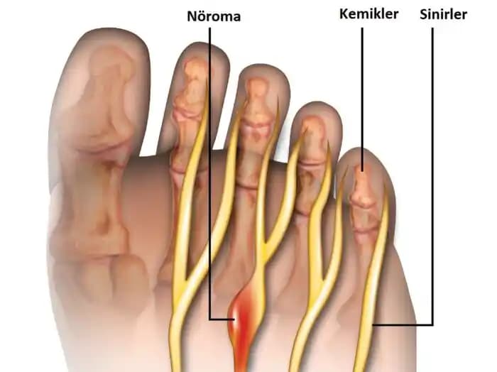Geniş Ayaklara Sahip Kadınlar İçin Kurumsal ve Konforlu Ayakkabı Seçenekleri